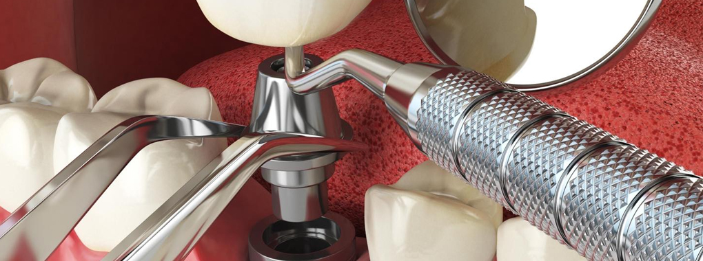 The Dental Consultants